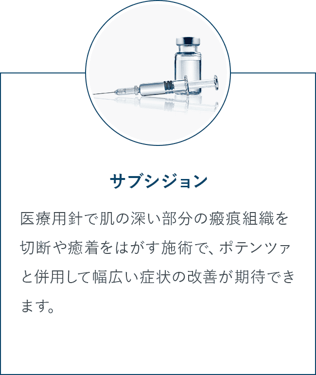 サブシジョン