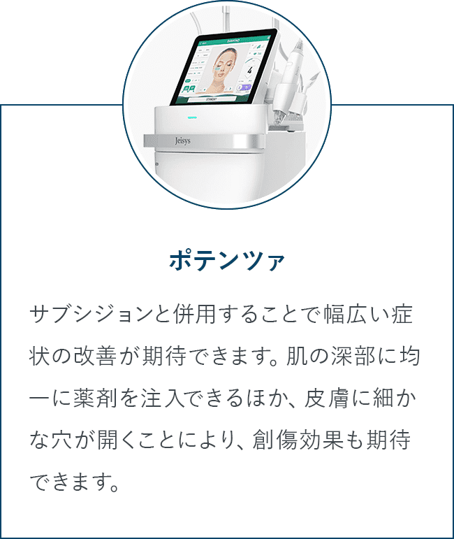 ポテンツァ